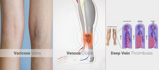 عيادة الوريد - أم القيوين - +971 58 584 6935